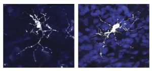 Left: An immune brain cell (microglia) in a human brain. Right: Microglia in the novel organoid model with a human-brain-like environment. The cells are almost indistinguishable.